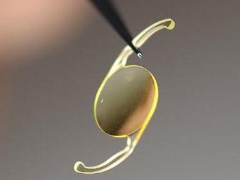 低温豆奶视频免费观看在线技术提高人工晶状体的亲水性，解决术后炎症问题-豆奶视频在线观看豆奶视频APP官网机