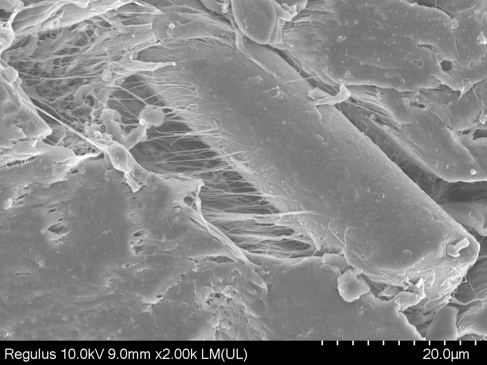 【豆奶视频在线观看】扫描电镜SEM观察豆奶视频APP官网机处理后的材料